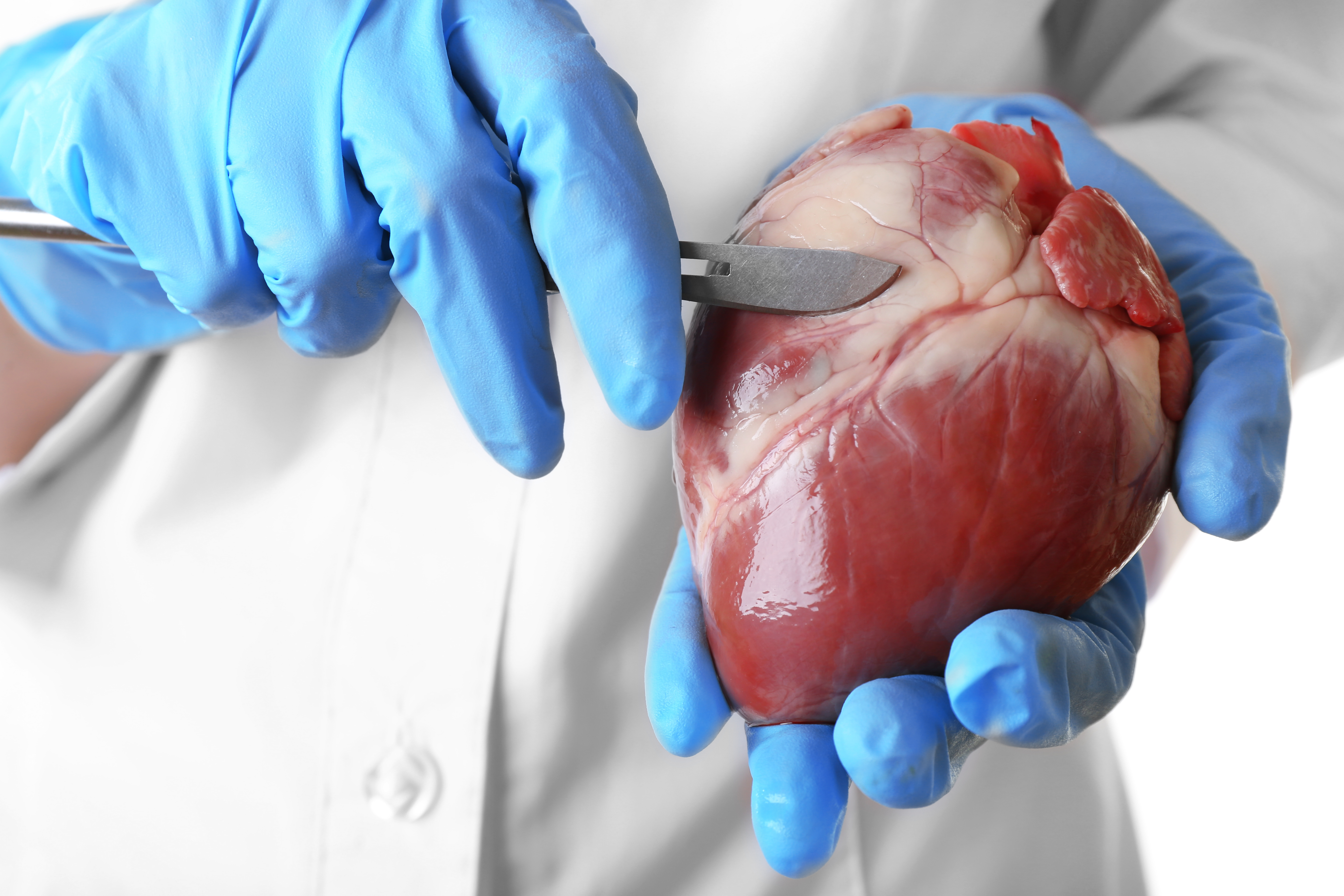 آزمایش‌های ایمونولوژی پیوند و HLA